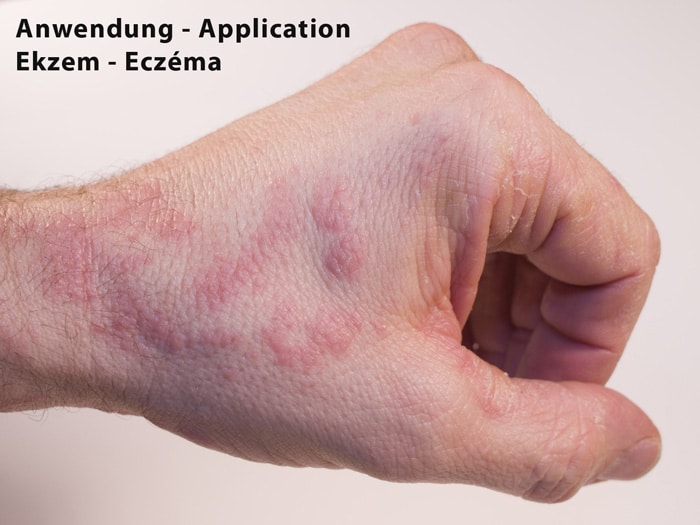 Silber_Handschuhe_bei_Raynaud_Ekzem_Best4Hand