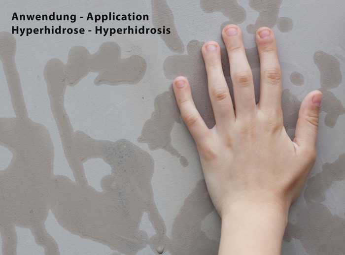 Silber_Handschuhe_bei_Hyperhidrose_Best4Hand
